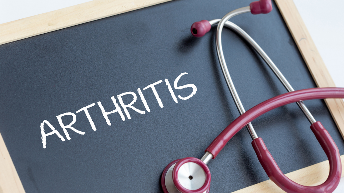 Arthritis Pain Relief: Managing Symptoms