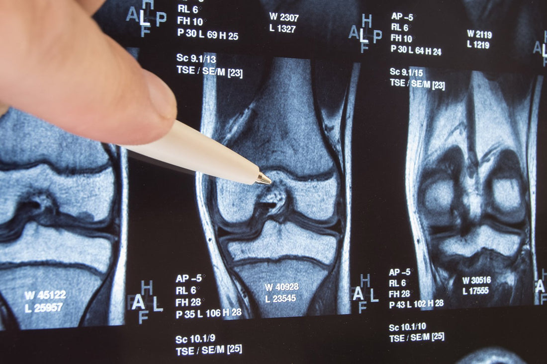 Joint Diseases: Everything You Need to Know